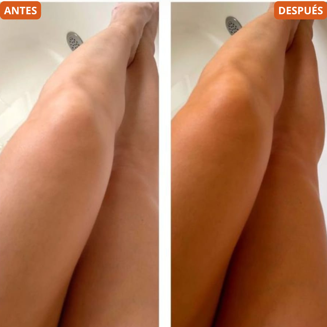 AUTOBRONCEADOR CLICPIE